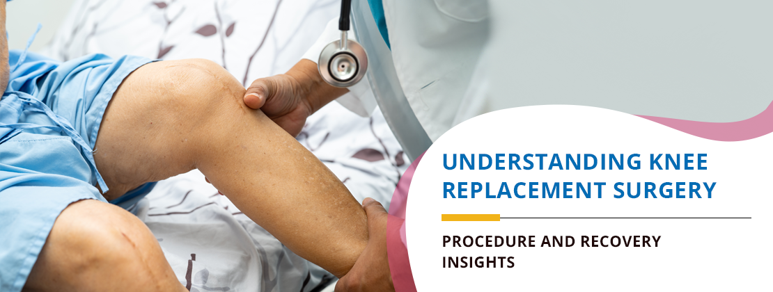 Understanding Knee Replacement Surgery - Procedure and recovery insights