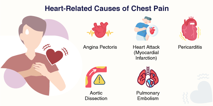 Heart-Related Causes of Chest Pain Heart-Related Causes of Chest Pain