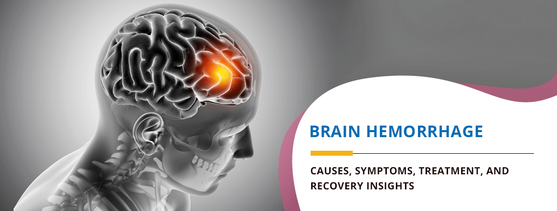 Brain Hemorrhage: Causes, Symptoms, Treatment, and Recovery Insights