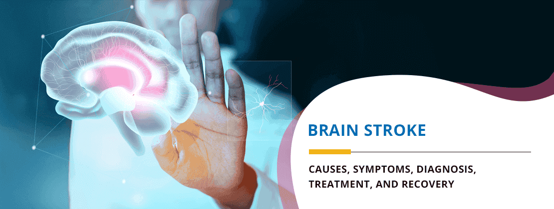 Brain Stroke: Causes, Symptoms, Diagnosis, Treatment, and Recovery