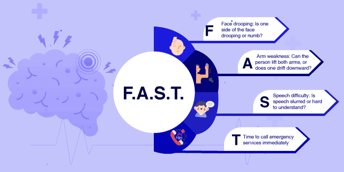 A simple way to remember stroke symptoms is the F.A.S.T. test