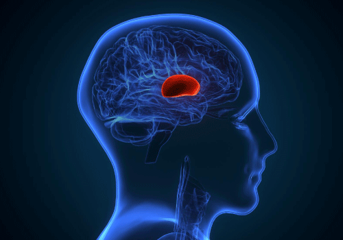 What are the Types of Brain Haemorrhages?
