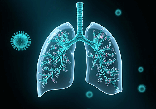 Common Airborne Infections That Affect Your Lungs in India
