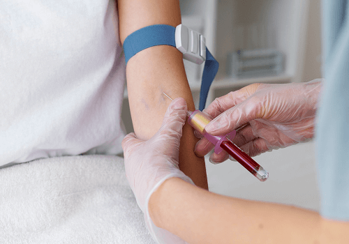 How to Diagnose Iron Deficiency Quickly