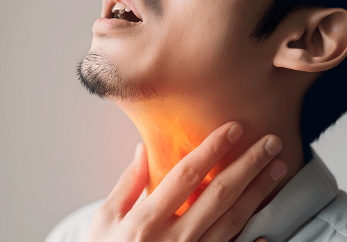 What is Dysphagia