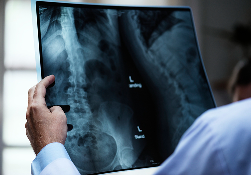 Diagnosis and Treatment