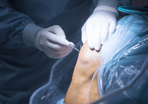 Types of Knee Replacement Surgeries Available