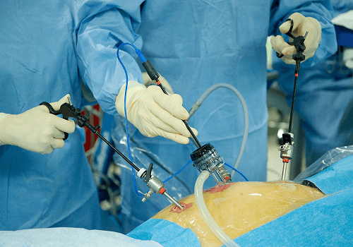 What Is Neuro and Vascular Interventional Radiology