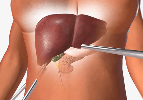 What is Gallbladder