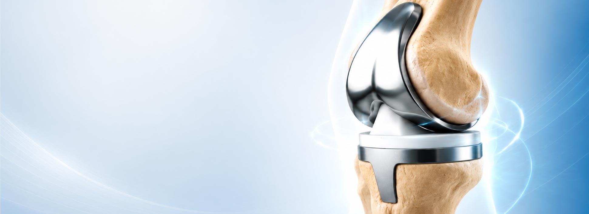 Knee Replacement Surgery in Ahmedabad