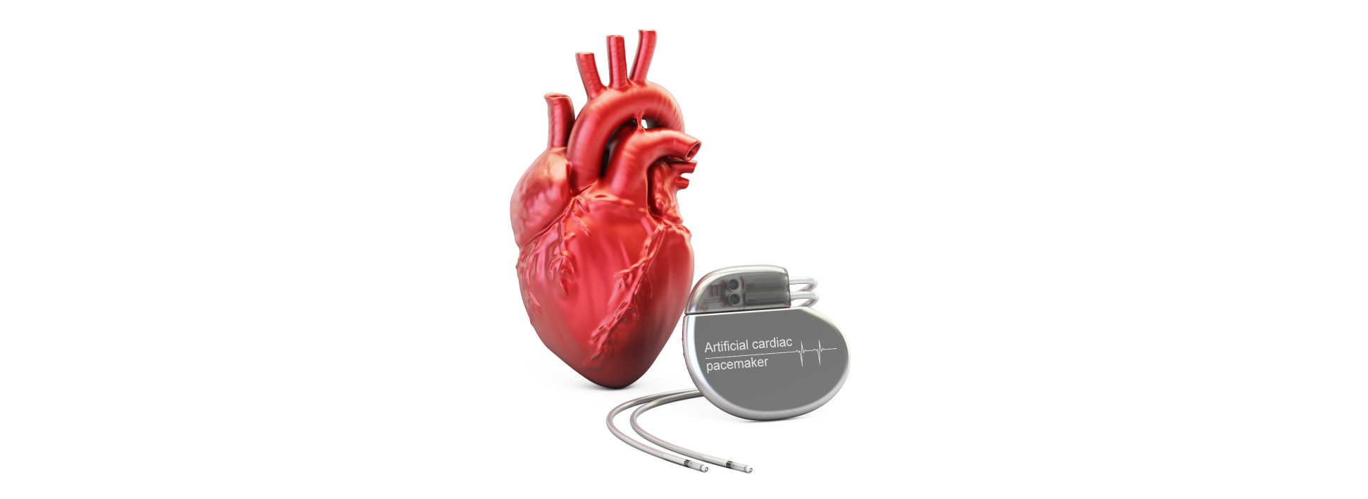 Pacemaker Implantation in Ahmedabad